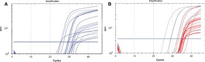 Using qPCR to compare the detection of Plasmodium vivax oocysts and sporozoites in Anopheles farauti mosquitoes between two DNA extraction methods